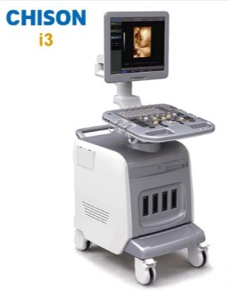 Chison i3-Ultrasound Machine